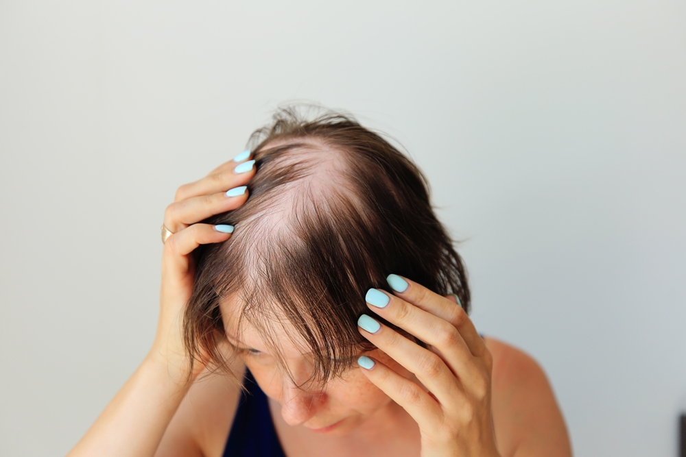 hair loss from menopause